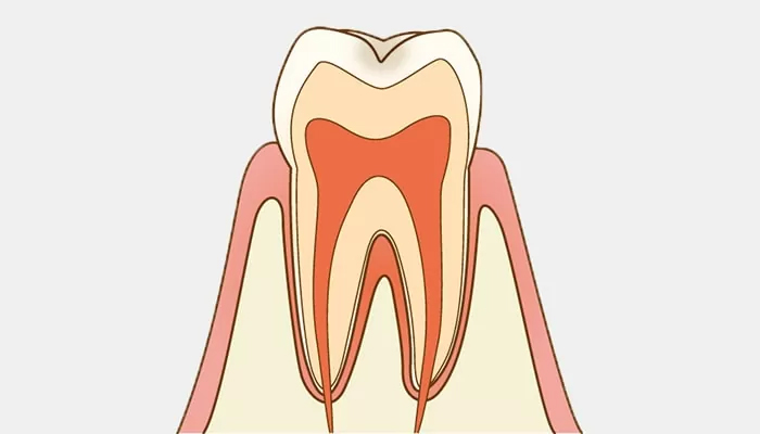 C0